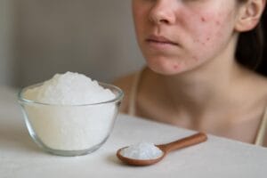 sol-epsom-na-tradzik-opinie-dermatologow-i-ryzyko-2-1